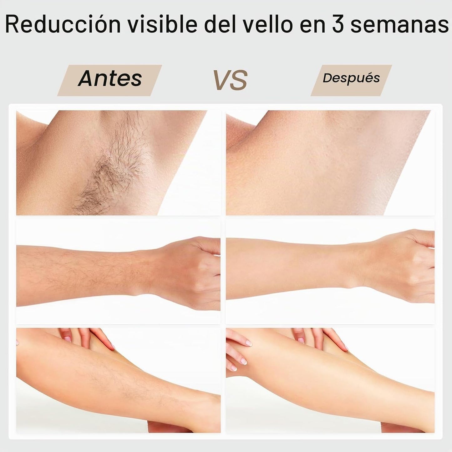 Depilación láser, BoSidin depilación IPL con enfriamiento de hielo...