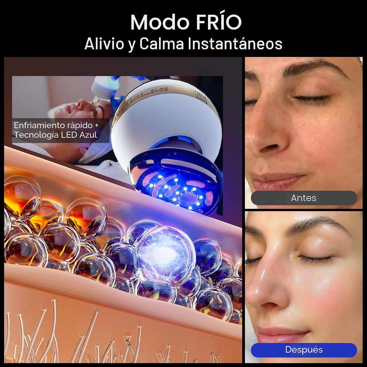 INIA SPHERA - Dispositivo facial de microcorriente 8 en 1 mejorado...