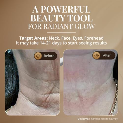 GLO24K - Masajeador facial LED para cara y cuello, varita de bellez...