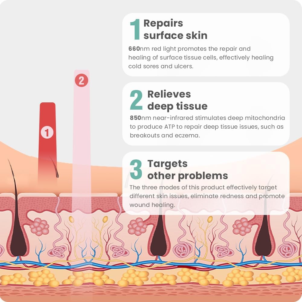Terapia de luz roja para la cara, dispositivo de terapia de luz roj...