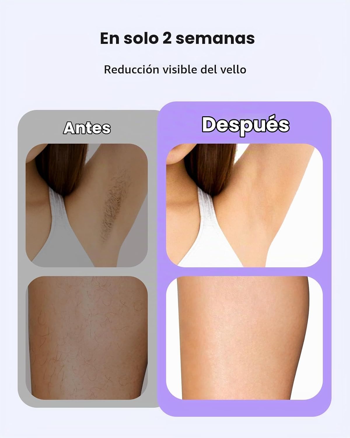 LYSMOSKI Depilación láser para mujeres y hombres, dispositivo de de...