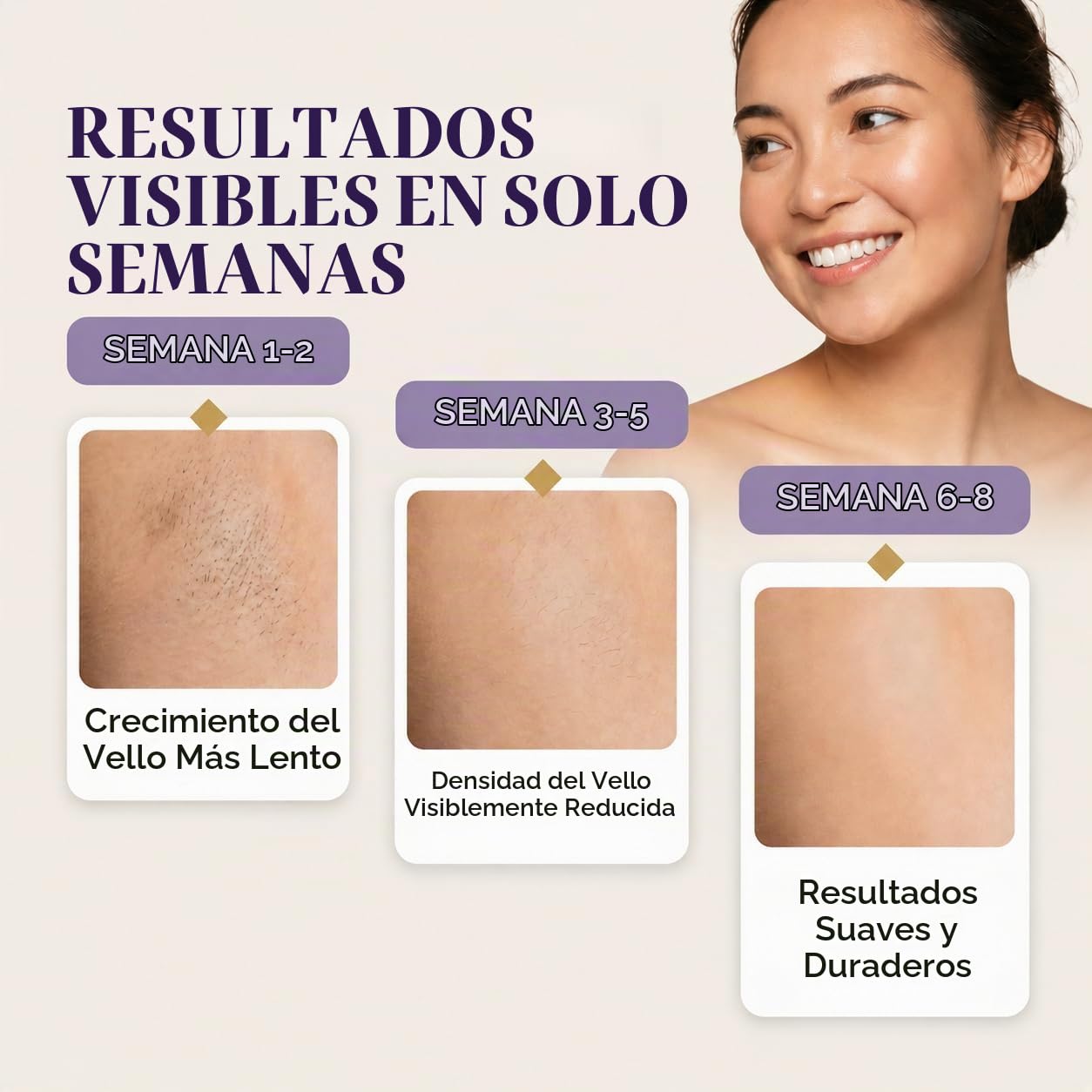 Skin Aurea™ Un dispositivo de depilación IPL inalámbrico 24J para r...