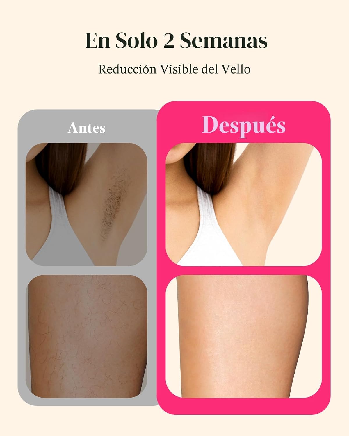 LYSMOSKI Depilación láser para mujeres y hombres, dispositivo de de...