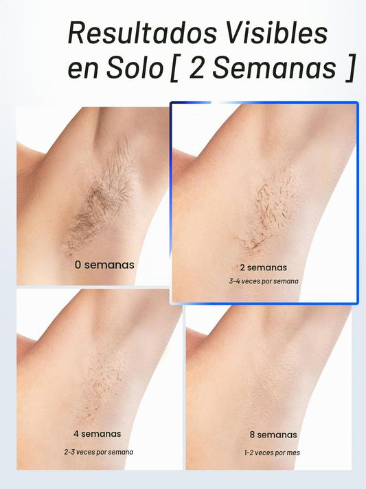 Blex - Depilación láser para mujeres y hombres, dispositivo de depi...