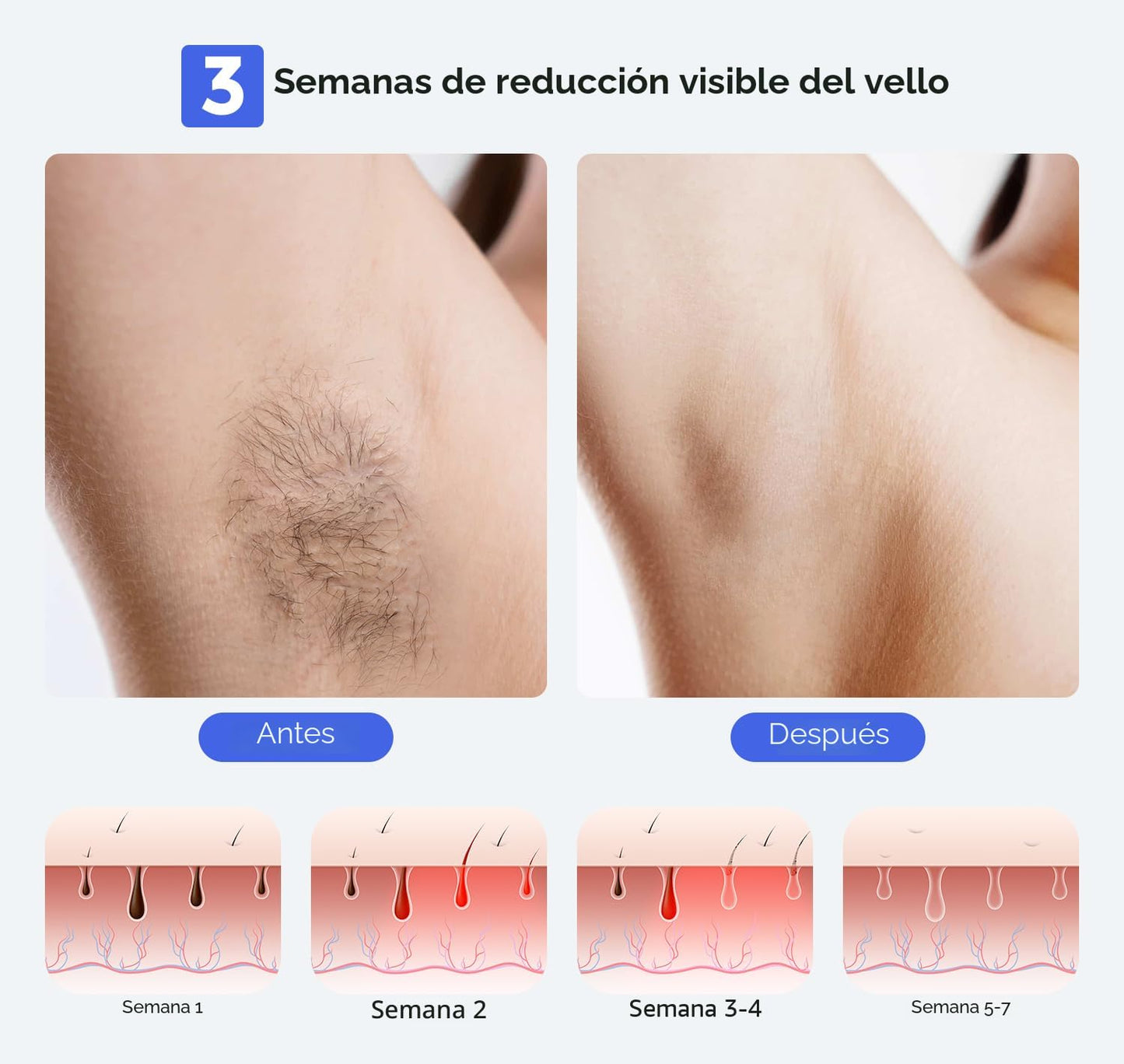 LUBEX Depilación láser IPL permanente inteligente para mujeres y ho...