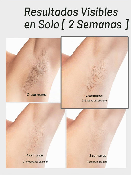 Blex Depilación láser para mujeres y hombres, dispositivo de depila...