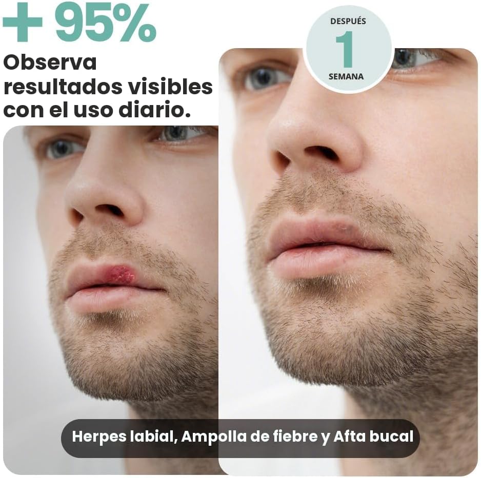 Terapia de luz roja para la cara, dispositivo de terapia de luz roj...