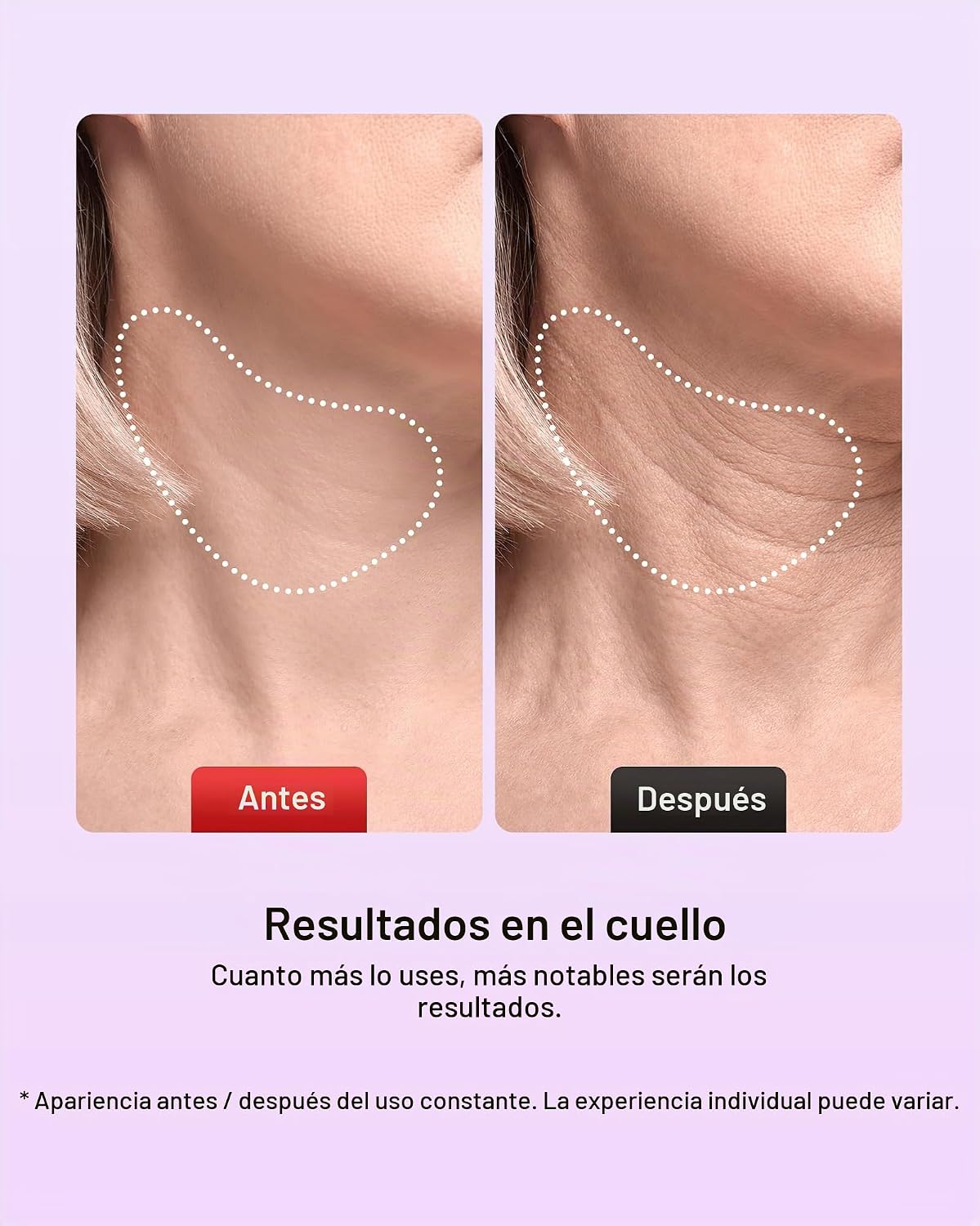 Pedete Masajeador facial, terapia de luz roja de 7 colores para car...