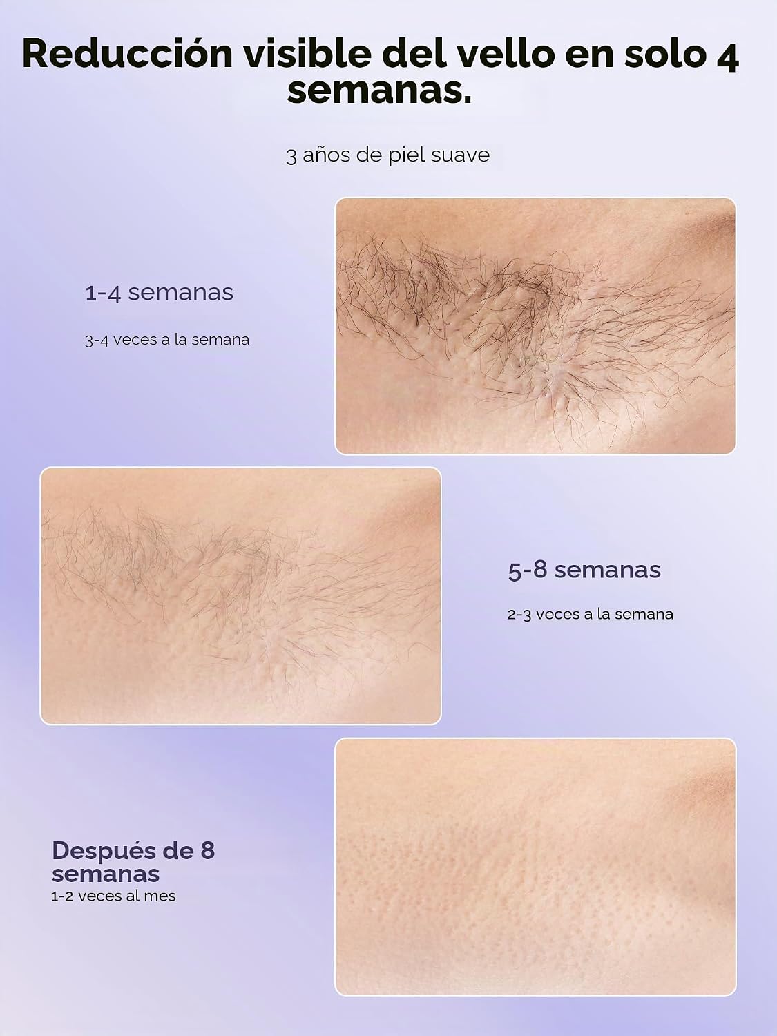 Ubroo Depilación láser con enfriamiento de hielo de 41.0 °F, dispos...