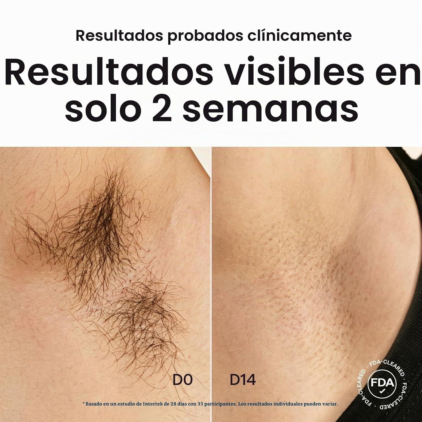 Depilación láser Wavytalk IPL, desnuda con rodillo de precisión par...