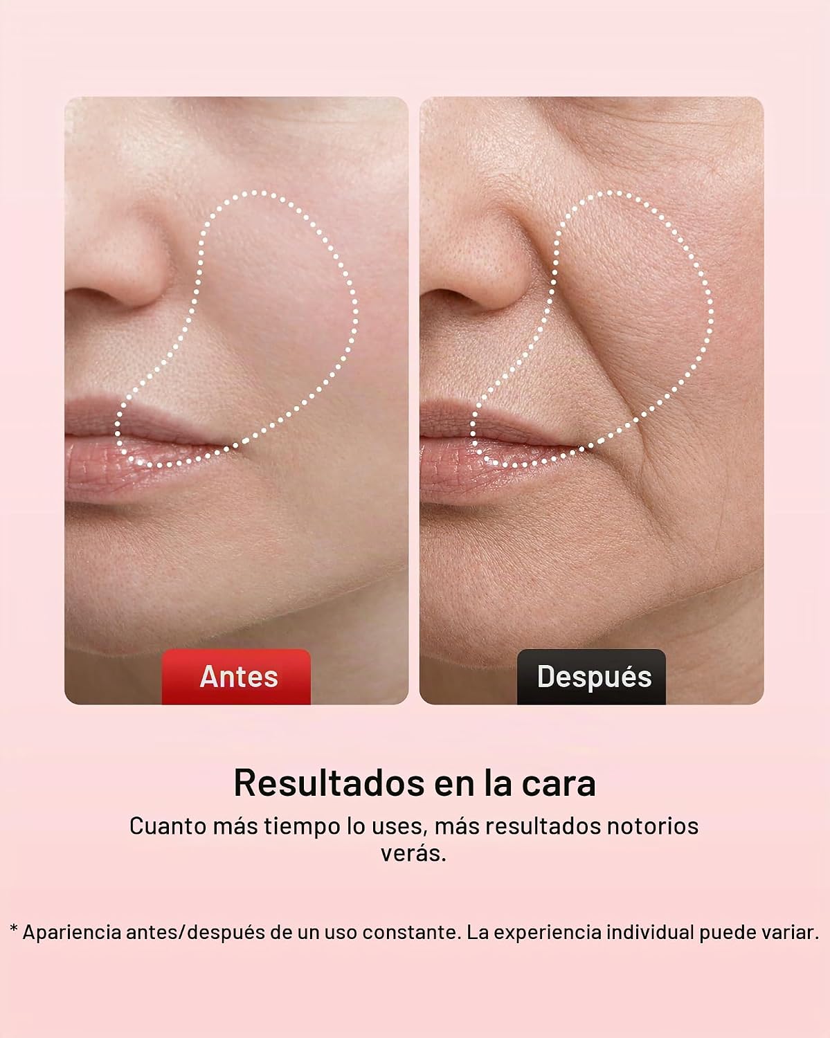 Pedete Masajeador facial, terapia de luz roja de 7 colores para car...