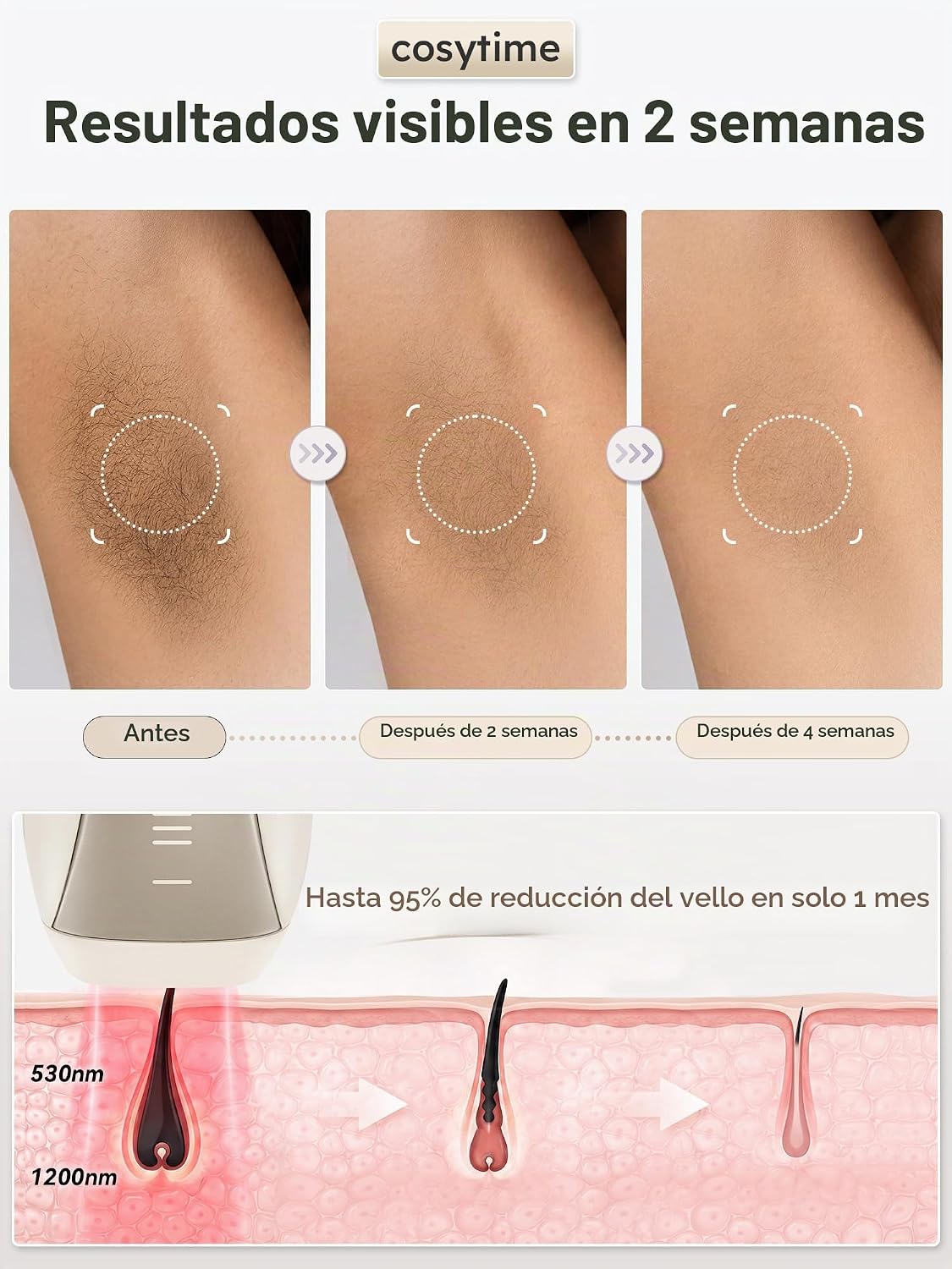 Cosytime Depilación láser IPL para mujeres y hombres, dispositivo d...