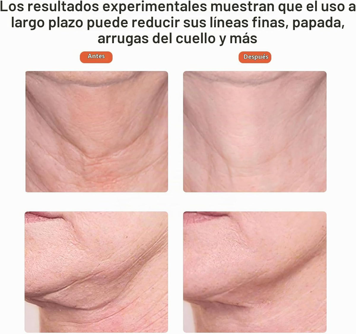Ms.W - Masajeador facial de luz roja, herramientas para el cuidado...