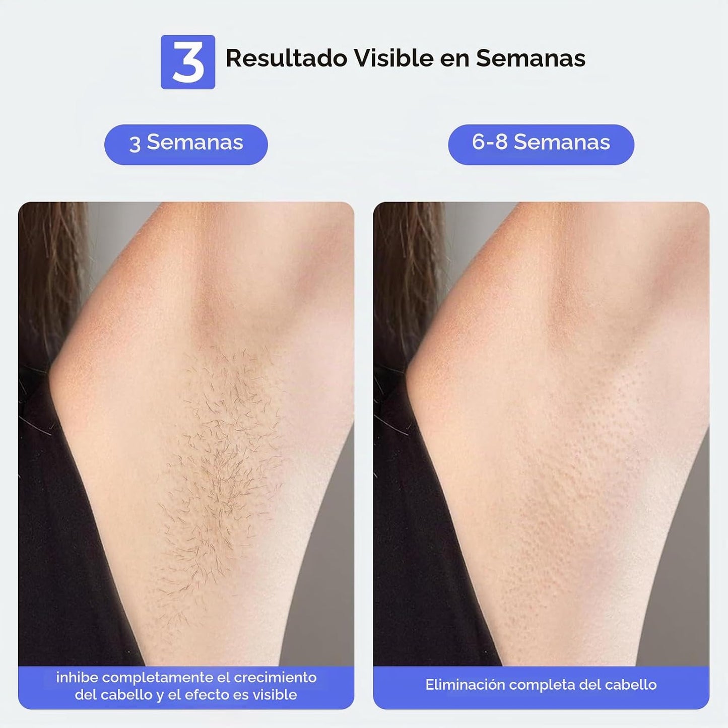 Mihilo Depilación láser, dispositivo de depilación láser IPL para m...