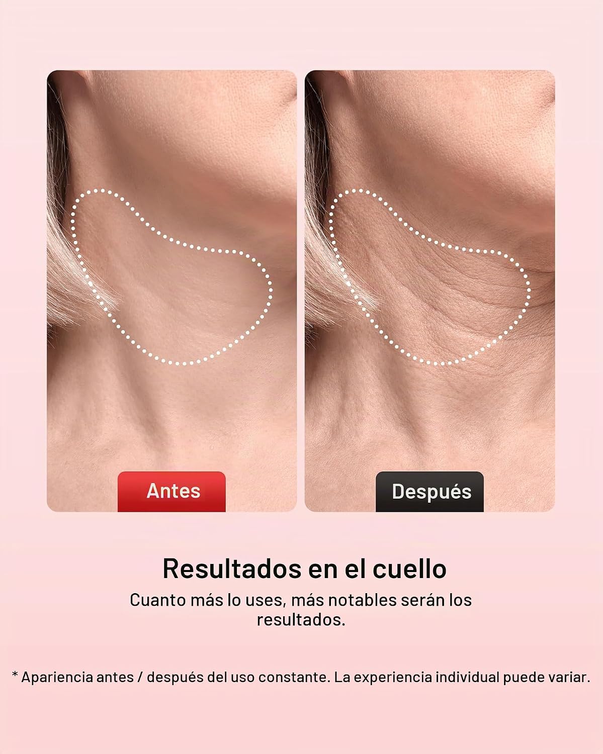 Pedete Masajeador facial, terapia de luz roja de 7 colores para car...