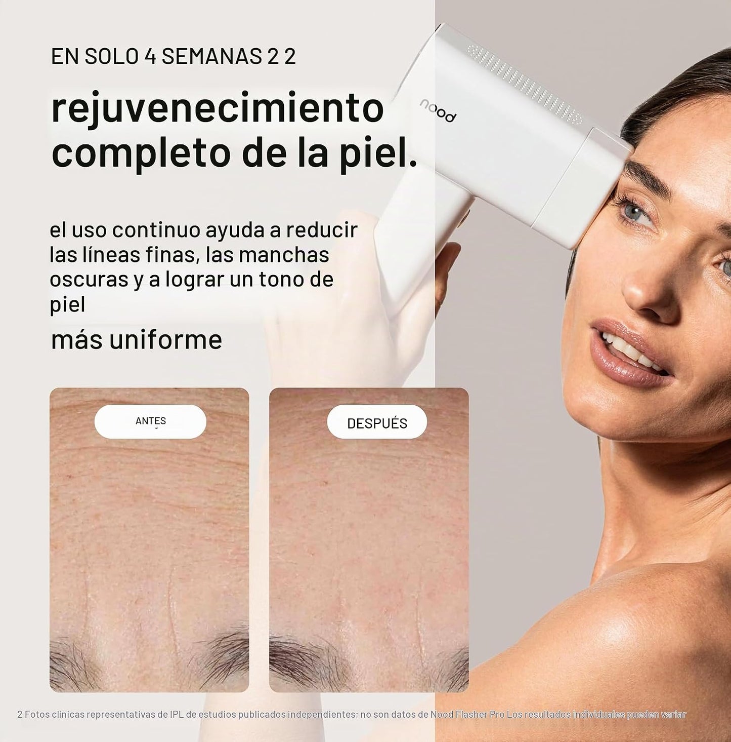 Kit Nood™ Flasher Pro | Dispositivo de depilación láser IPL con cui...