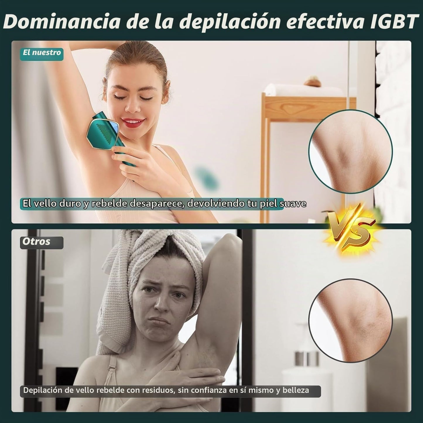 Depilación láser IPL para mujeres y hombres, resultados de larga du...