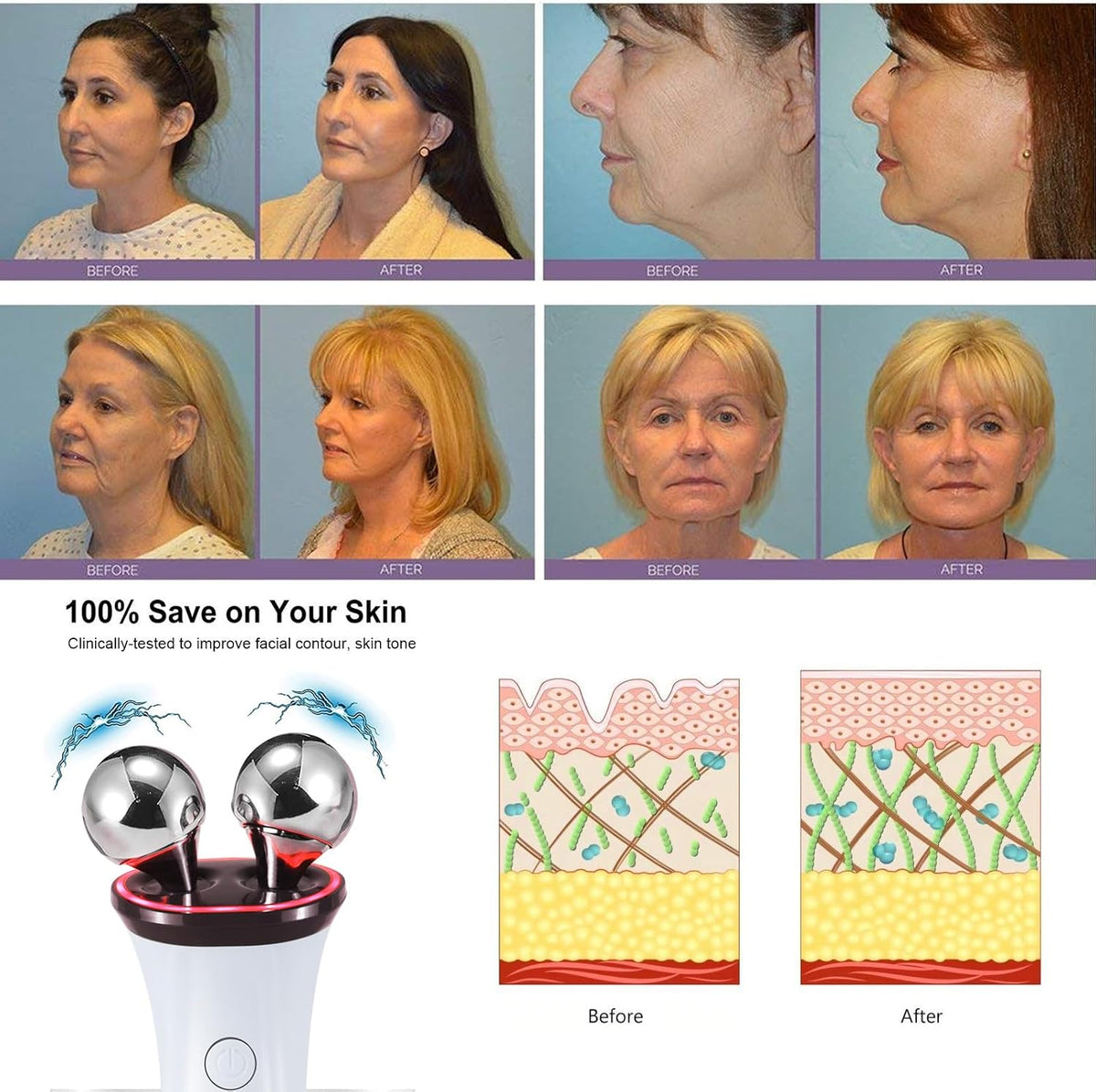 Dispositivo facial de microcorriente \u2013 Elevación facial eléctr...
