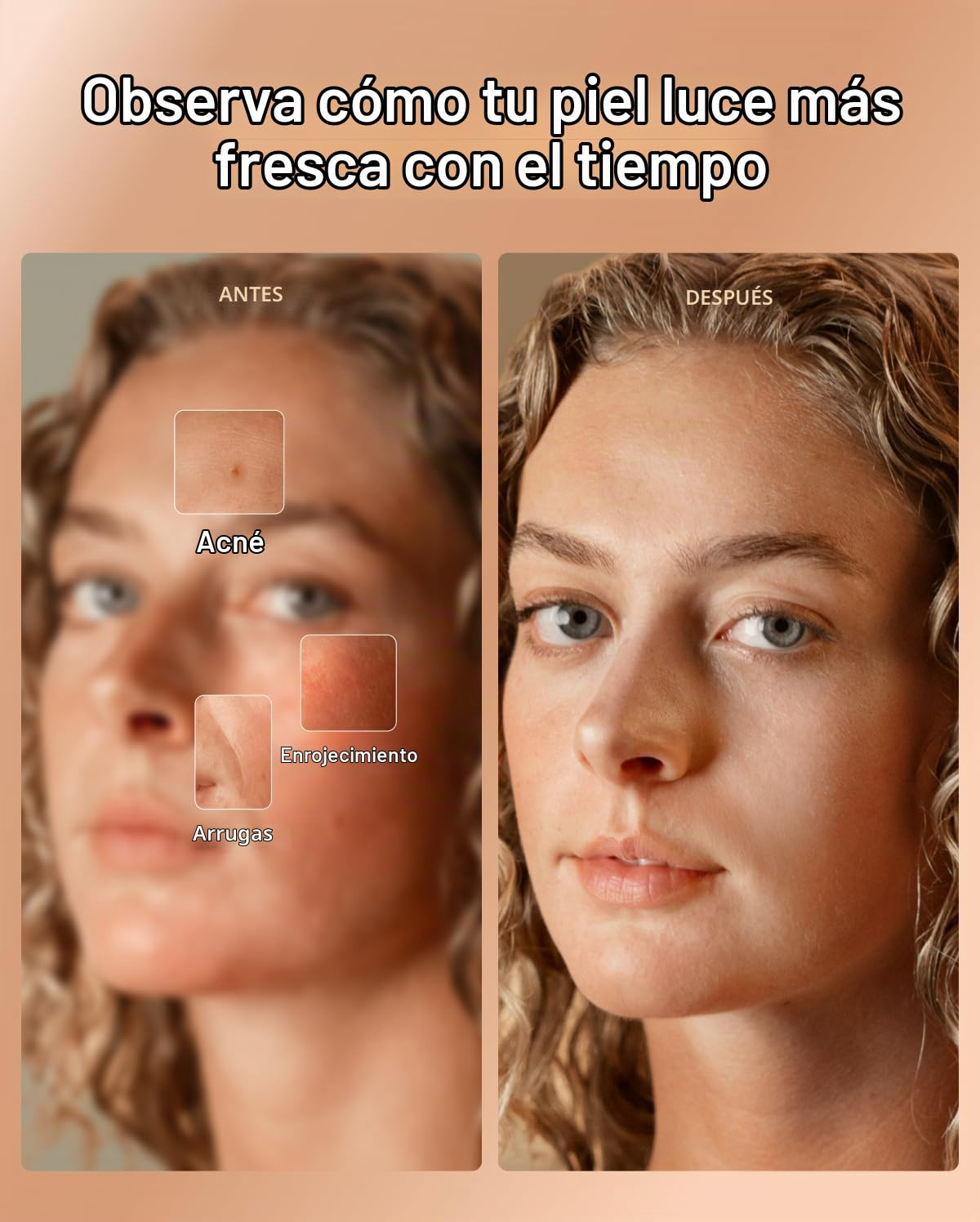 RENPHO Máscara de terapia de luz roja para cara, aprobada por la FD...