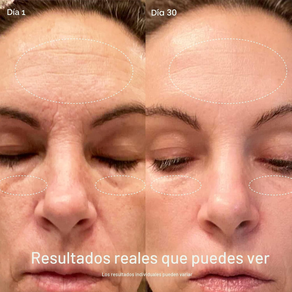 Solawave Varita de terapia de luz roja 4 en 1 para cara y cuello (c...