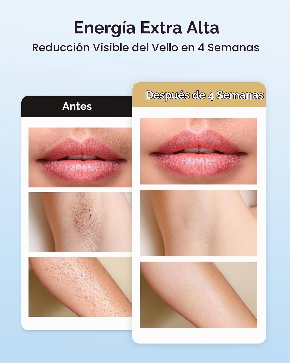 INNZA Depilación IPL con función de cuidado de enfriamiento de hiel...