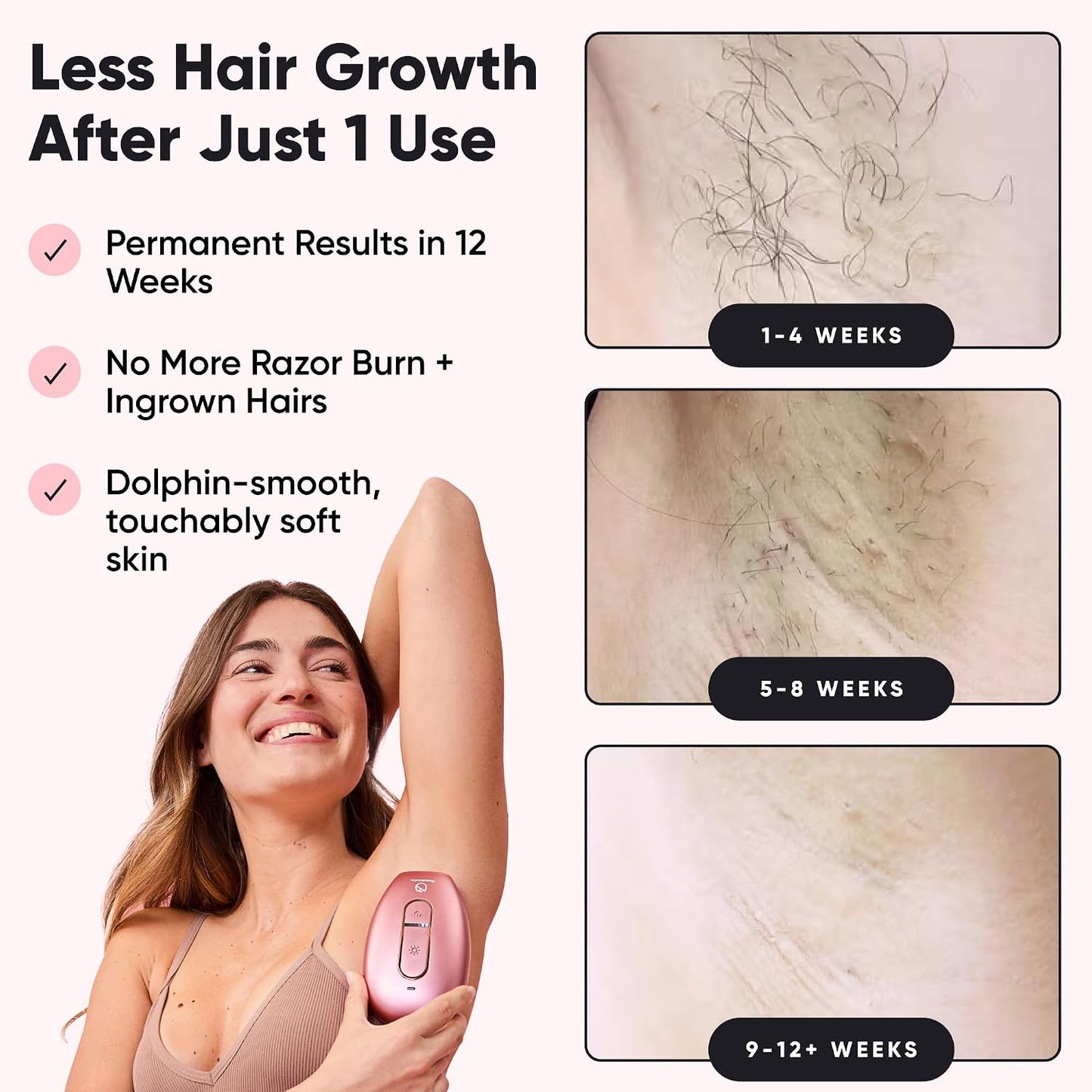 RoseSkinCo Lumi - Dispositivo de depilación láser IPL, reducción pe...