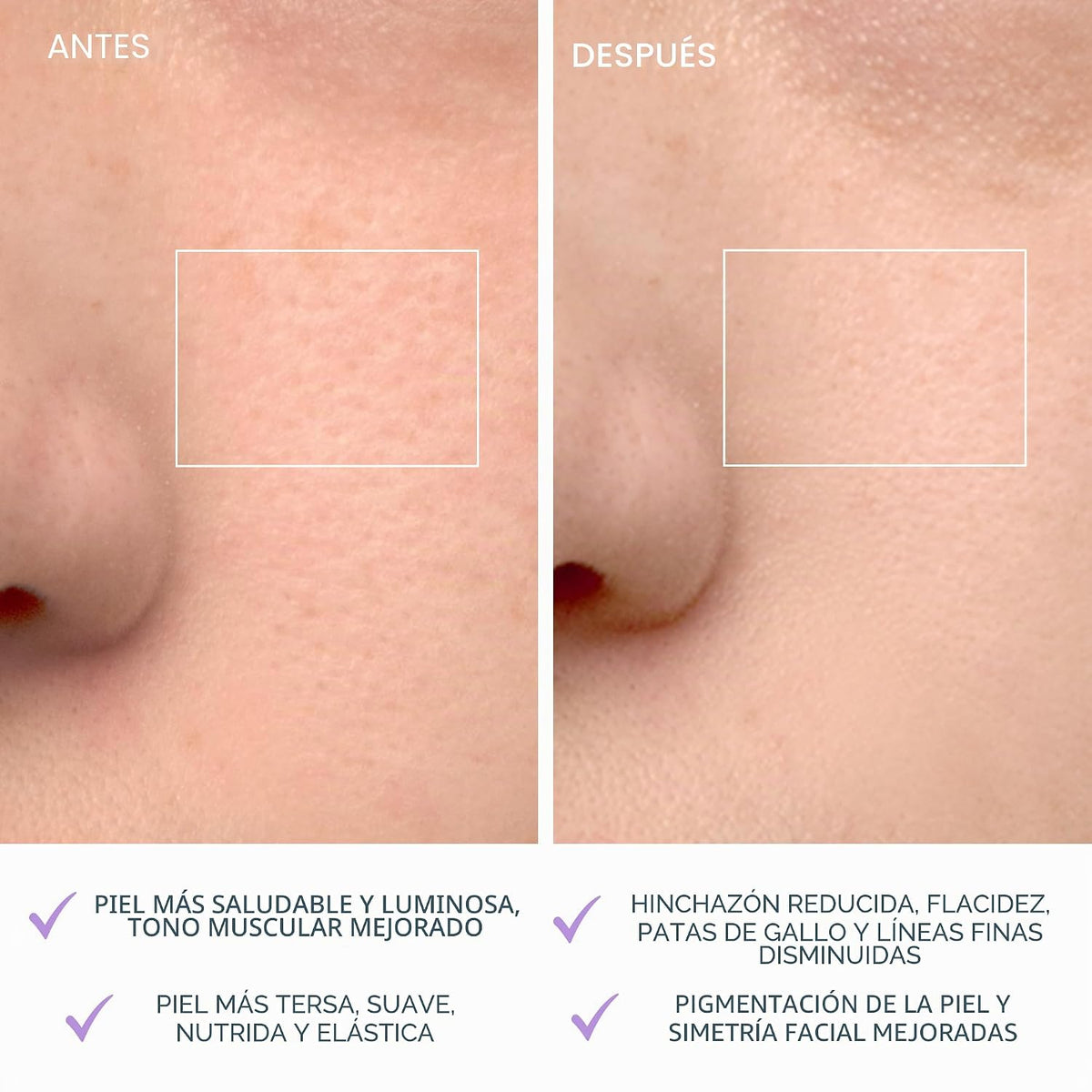 FOREO LUNA 4 Cepillo de limpieza facial - Masajeador facial reafirm...
