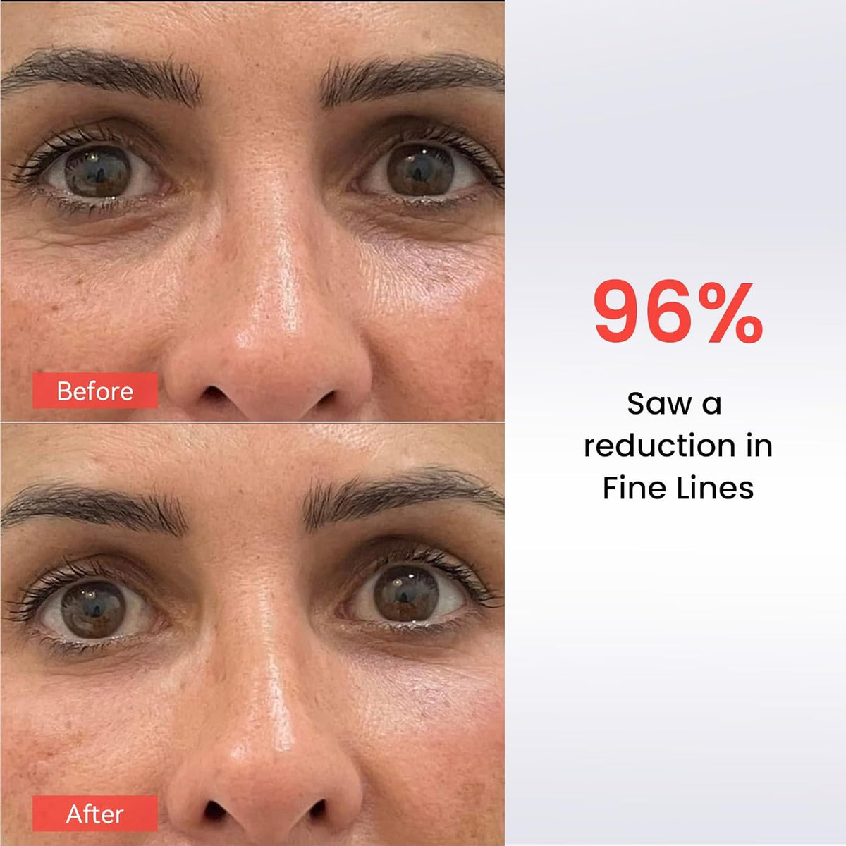 AMIRO Máscara de terapia de luz roja para ojos + máscaras reafirman...