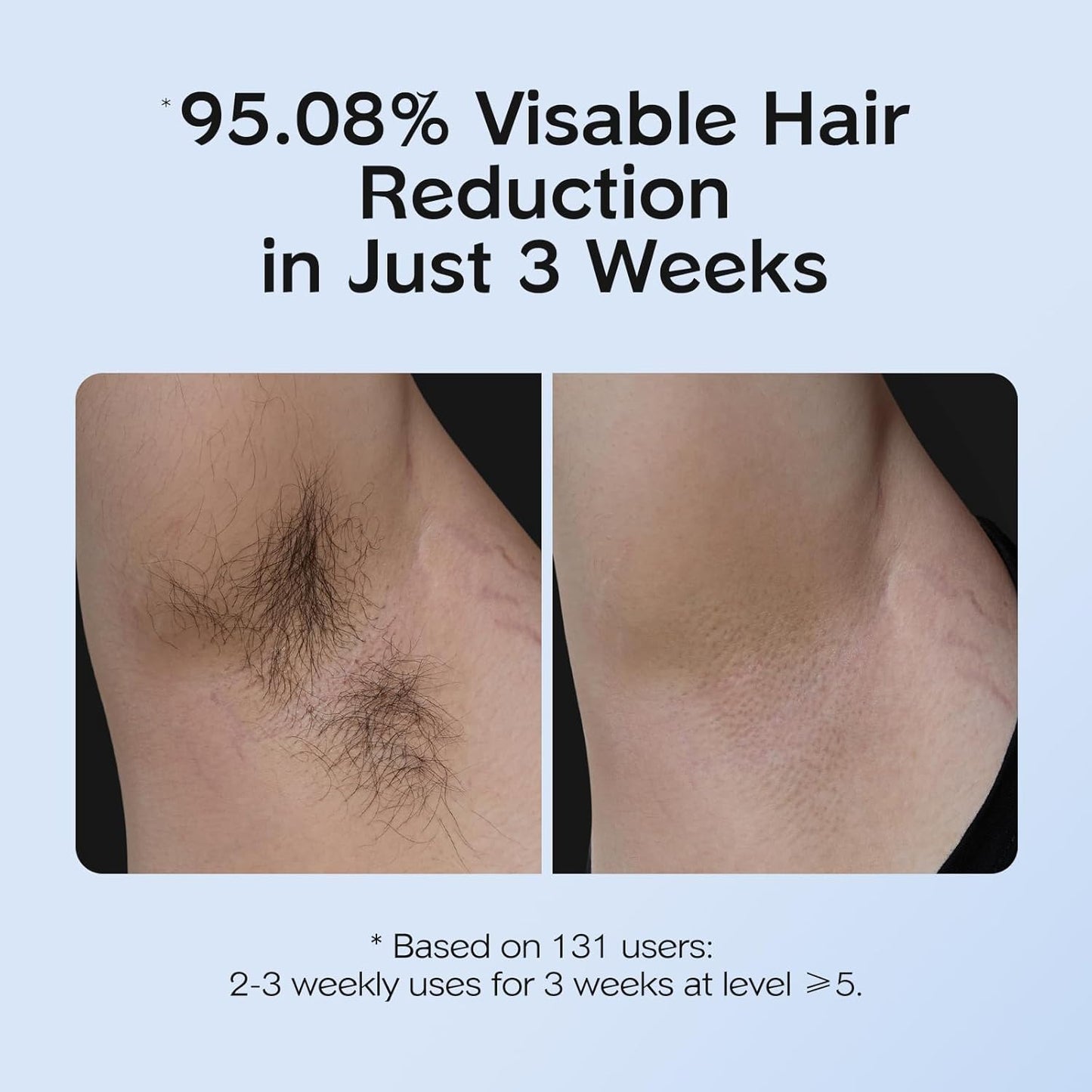 INNZA - Depiladora IPL con función de enfriamiento por hielo para m...