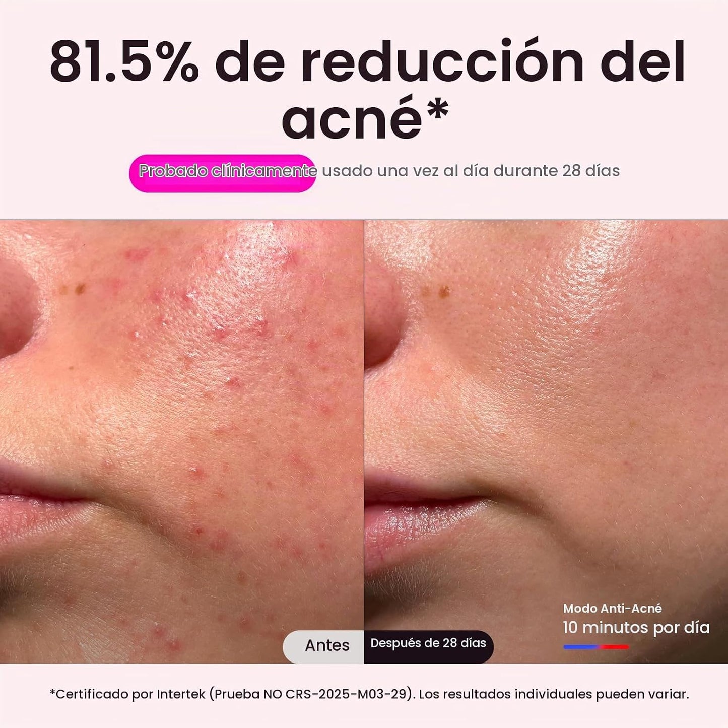 Máscara de la terapia de la luz roja de Wavytalk para la cara, másc...
