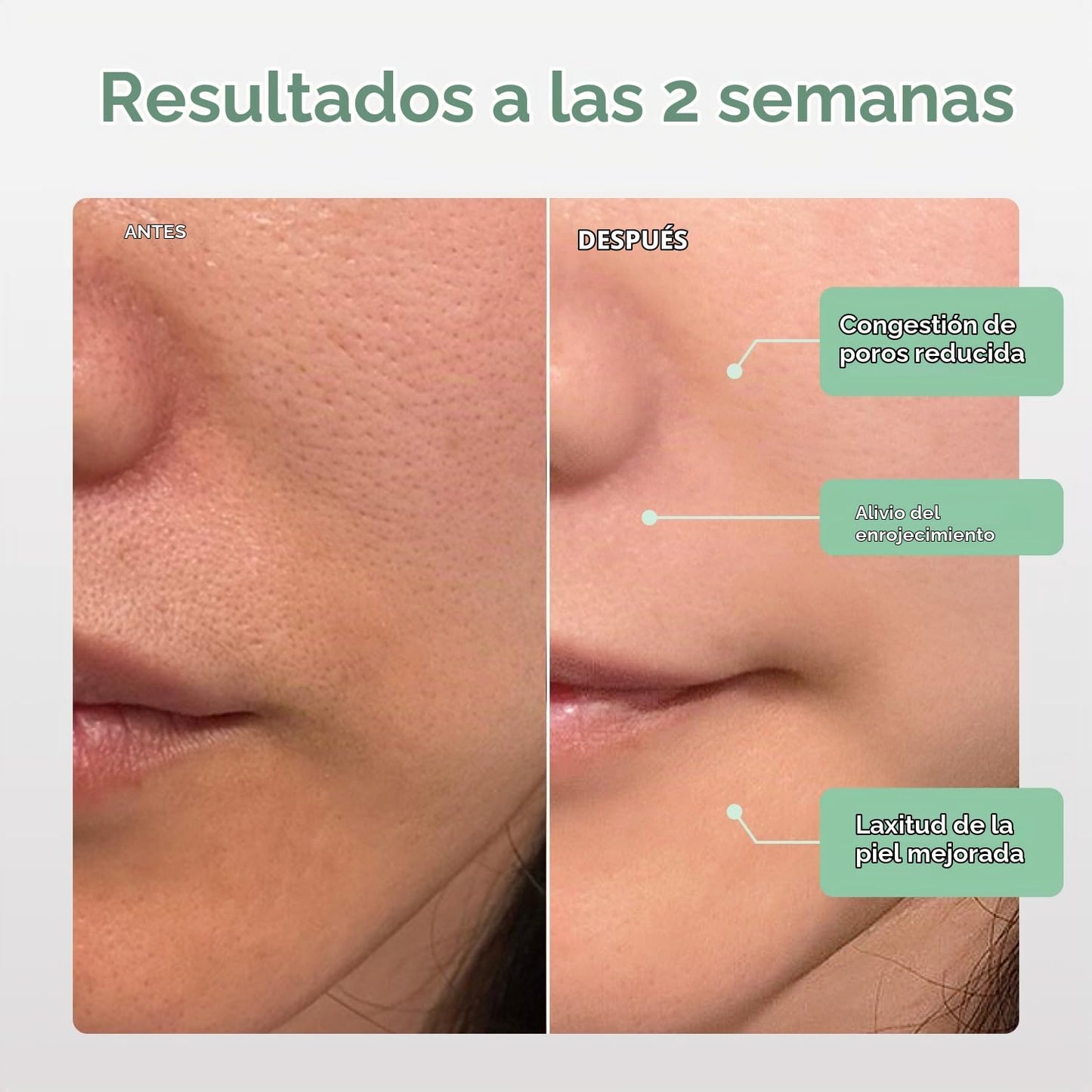 Nanoleaf Máscara facial LED aprobada por la FDA con 7 modos de tera...