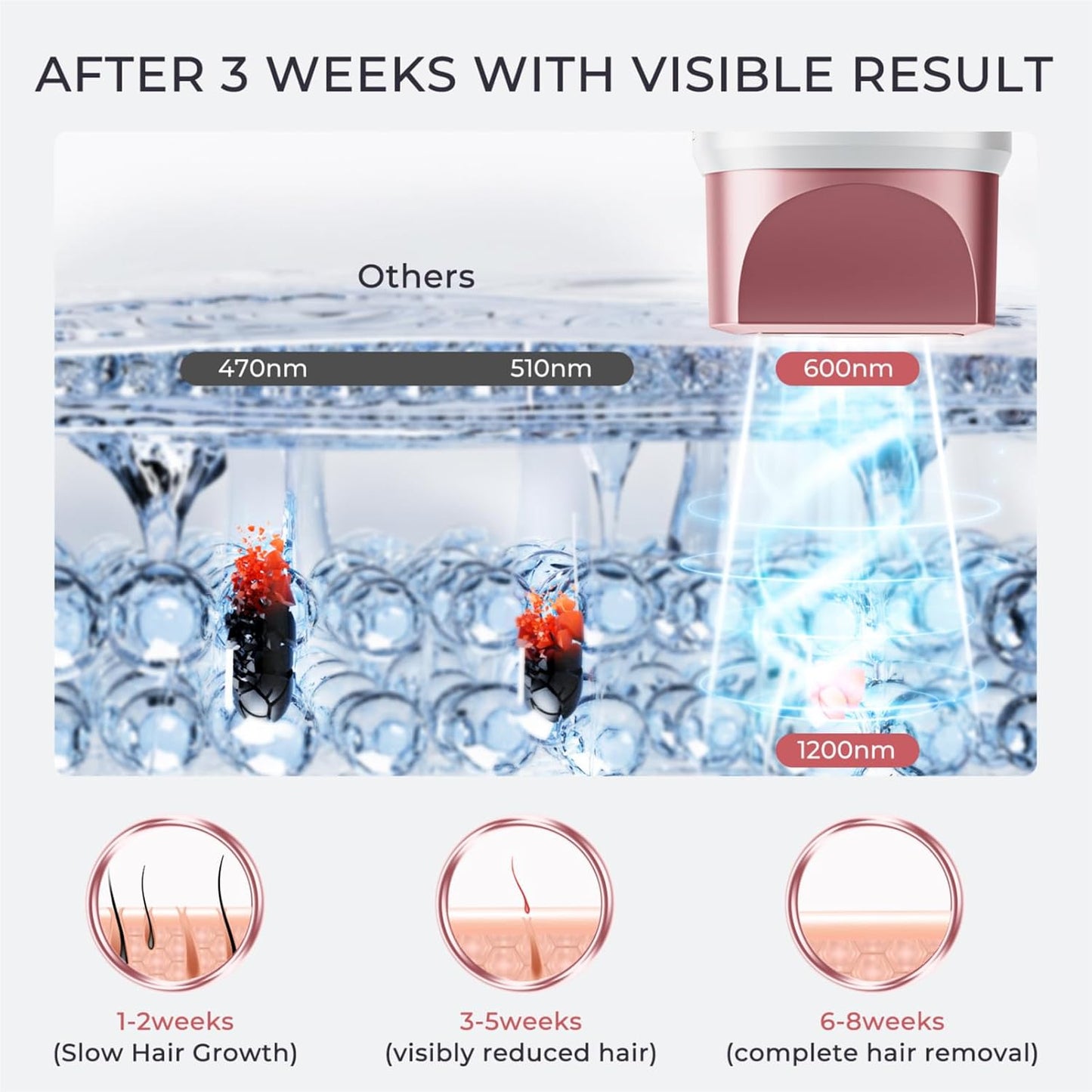 ZAIRUZ Depilación láser IPL para mujeres y hombres, depilación con...