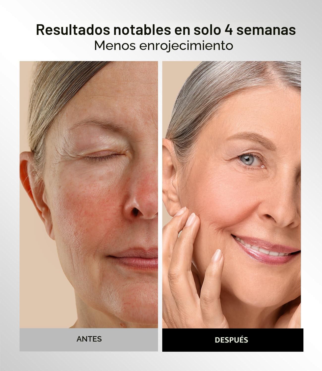 INIA Máscara de terapia de luz roja para cara, 4 modos de luz con N...