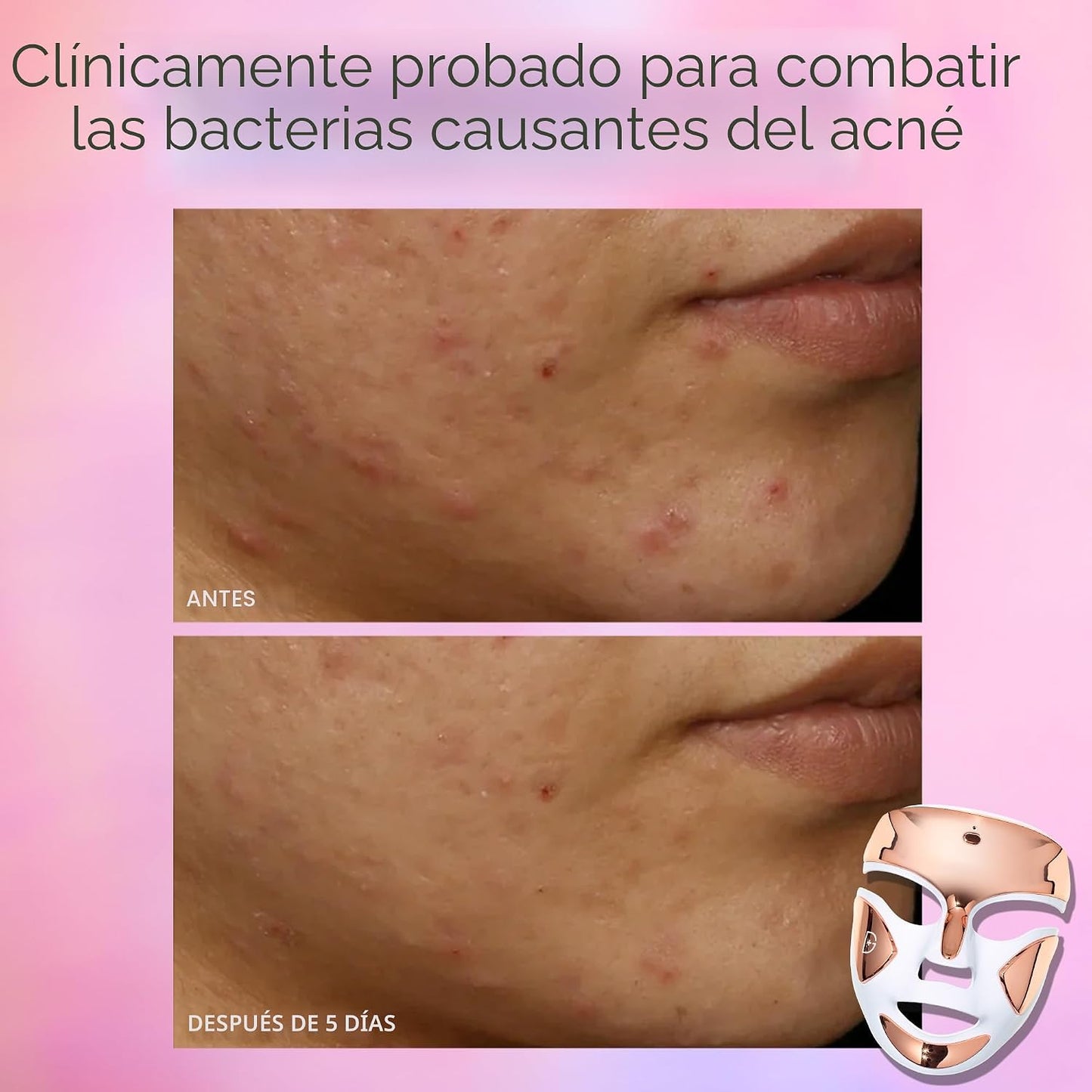 Dr. Dennis Gross DRx SpectraLite FaceWare Pro - Máscara facial LED...