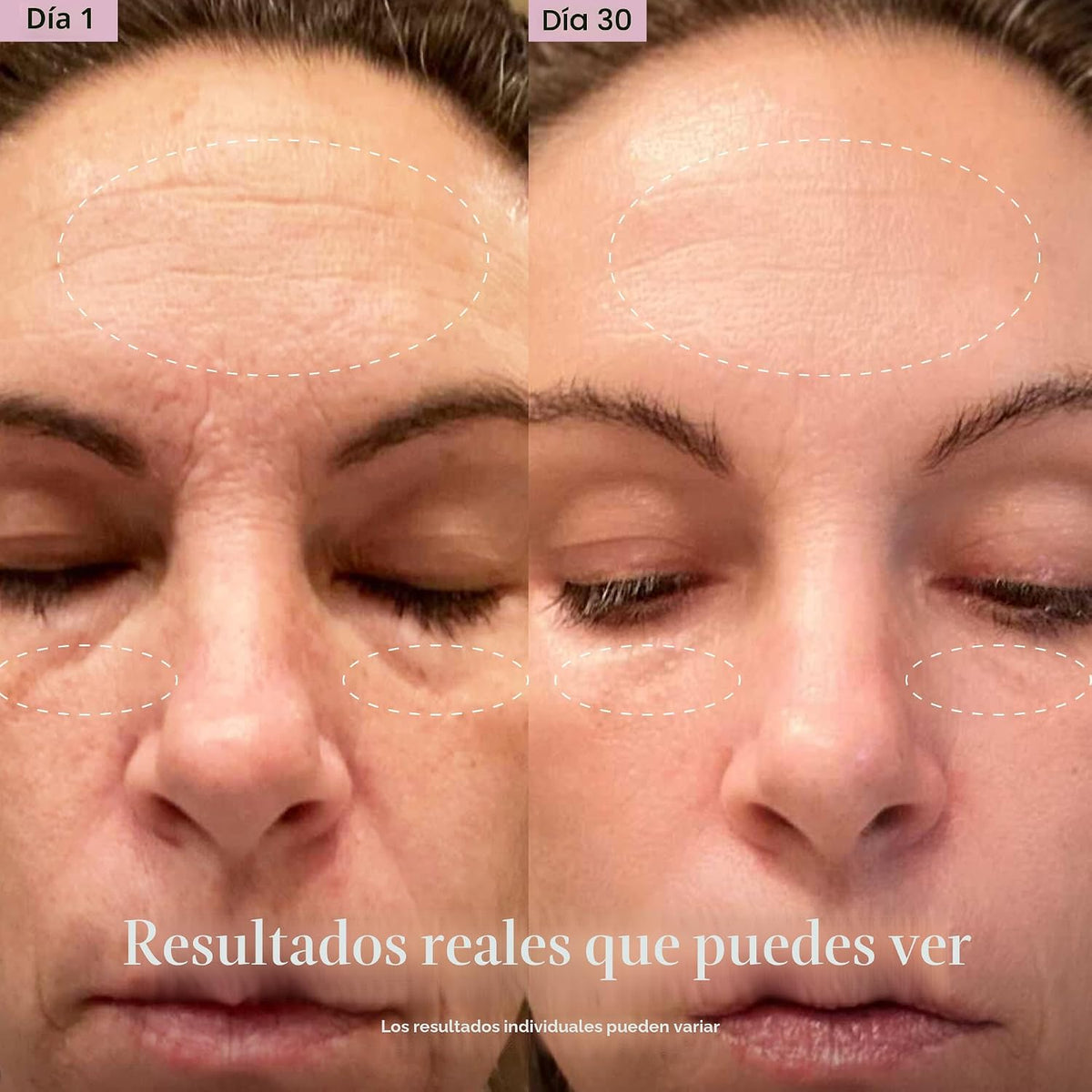 Solawave Varita de terapia de luz roja 4 en 1 para cara y cuello (o...
