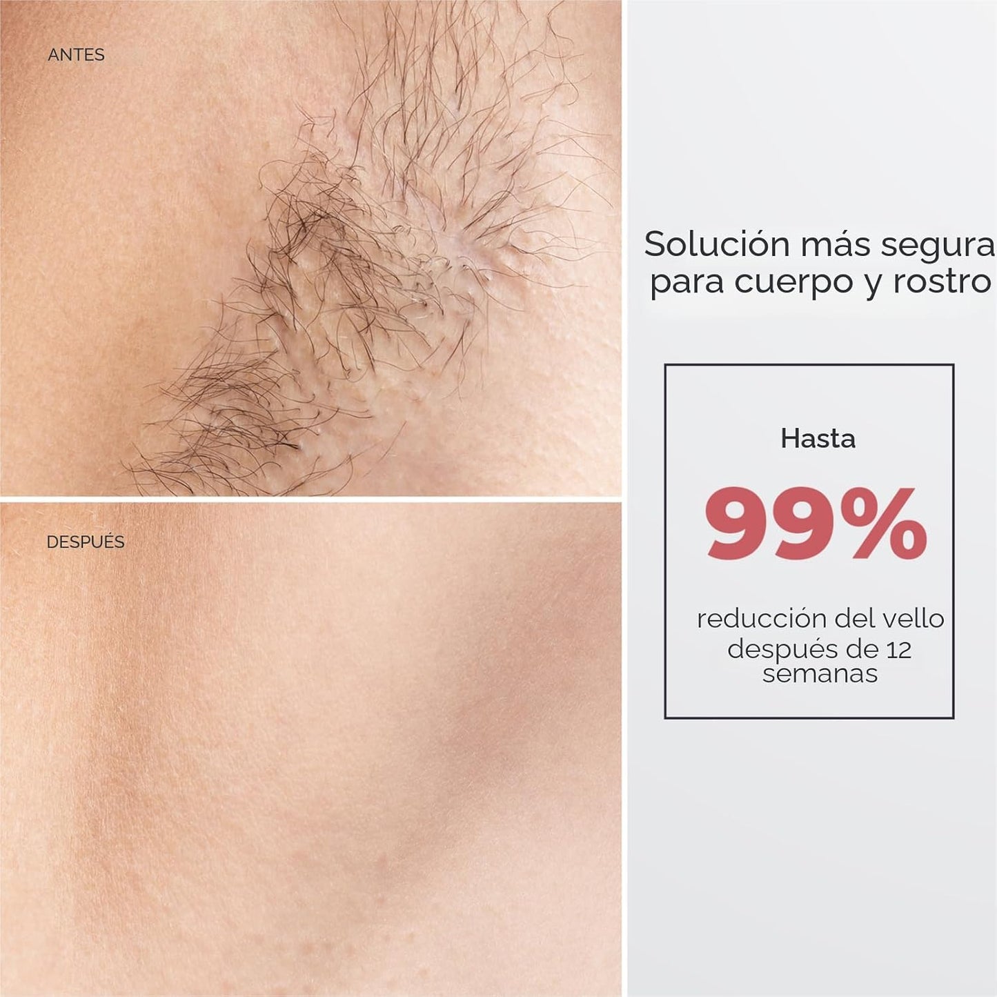 ZAIRUZ Depilación láser IPL para mujeres y hombres, depilación con...