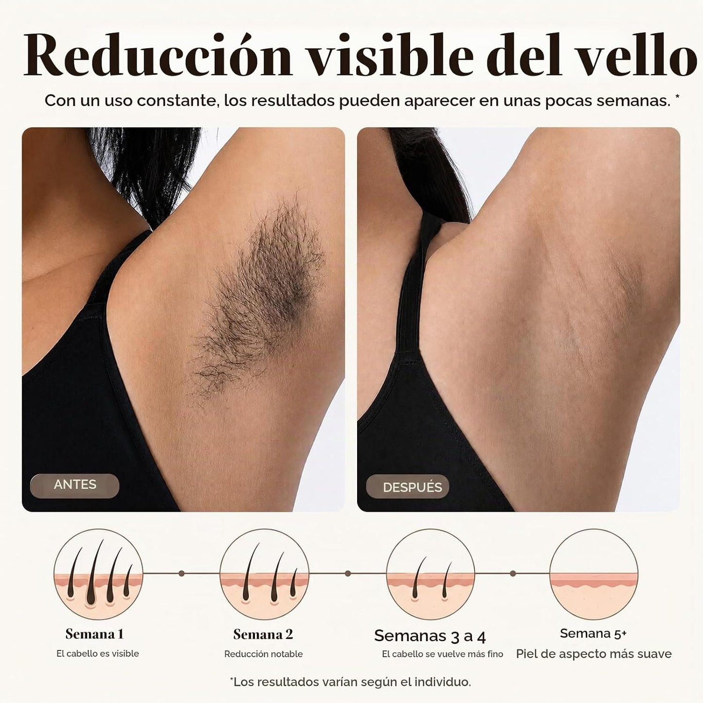 Dispositivo de depilación láser Mithlux para mujeres, IPL con enfri...