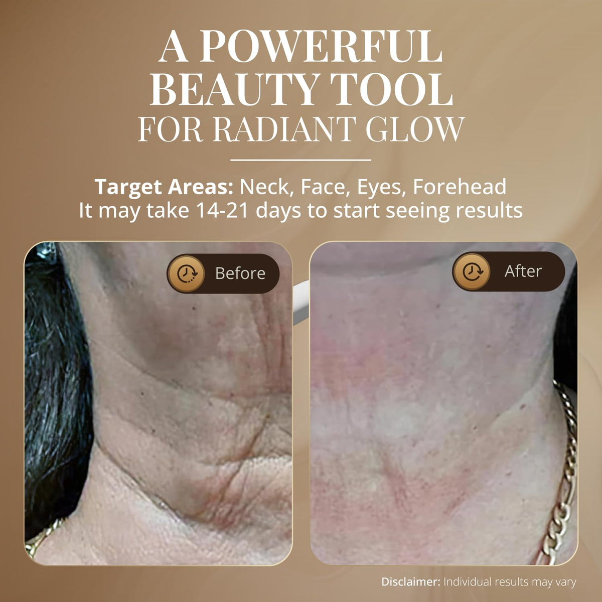 GLO24K - Masajeador facial LED para cara y cuello, varita de bellez...
