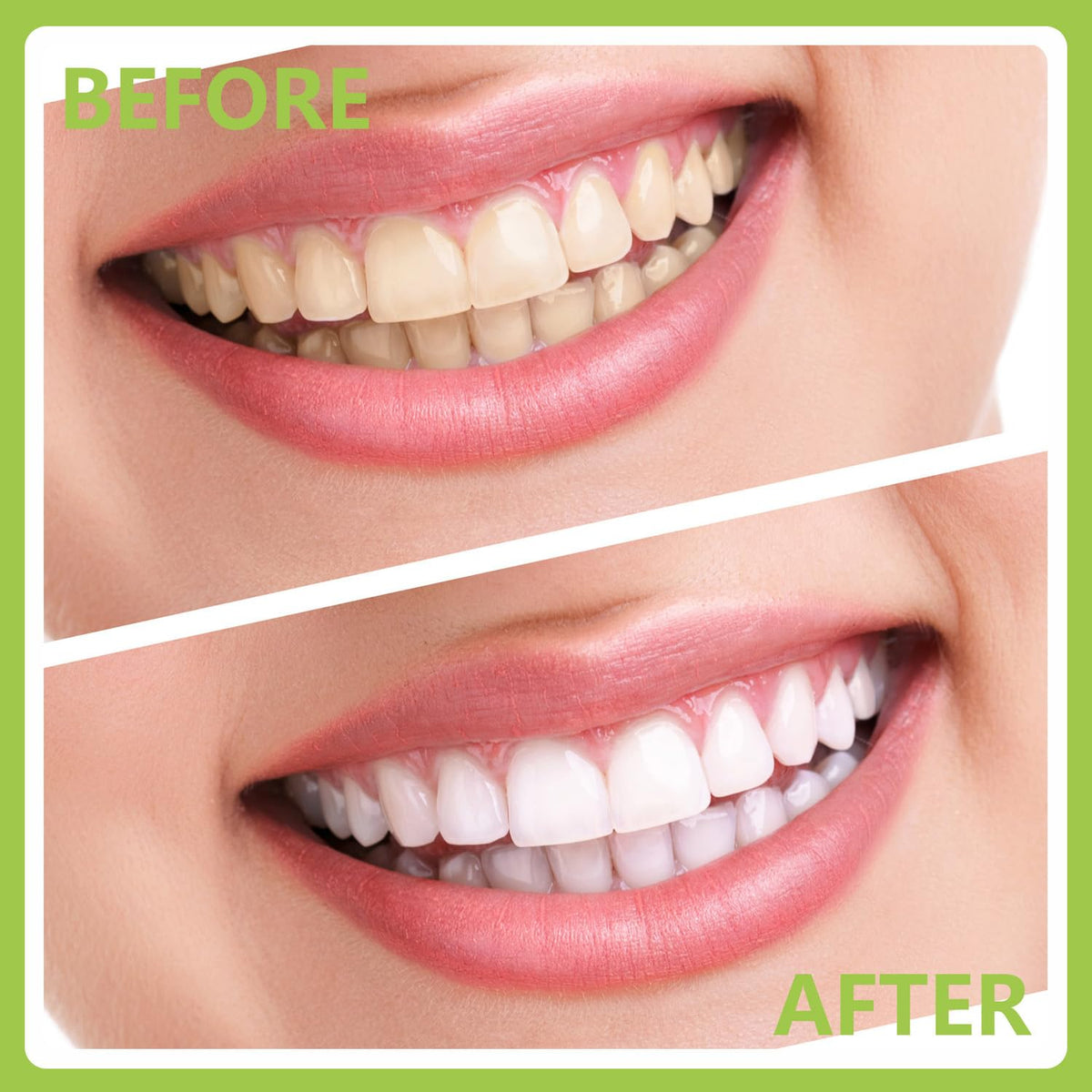 PARYUNGR Herramientas Dentales, Kit Profesional de Higiene y Cuidad...