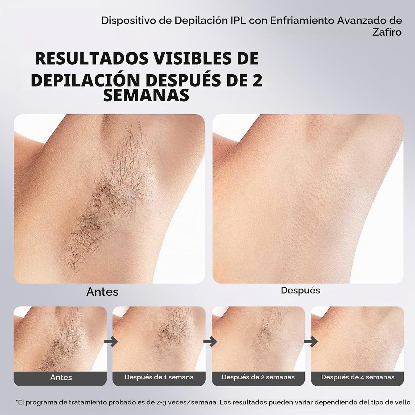 EUARNE Depilación láser IPL para mujeres, enfriamiento de hielo, ef...