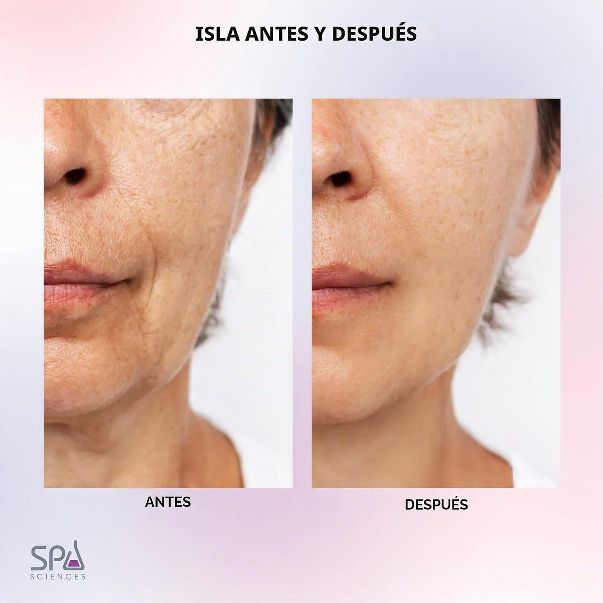 Spa Sciences ISLA Ice + Heat - Rodillo de contorno de cara, cuello...