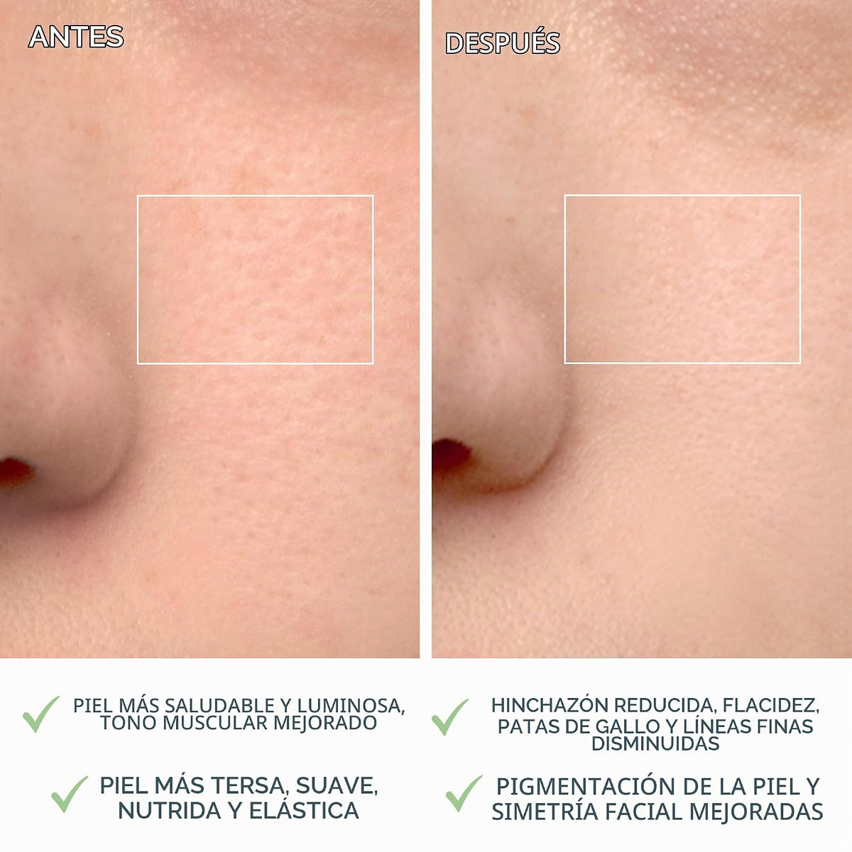 FOREO LUNA 4 Cepillo Limpiador Facial - Masajador - Antienvejecimie...
