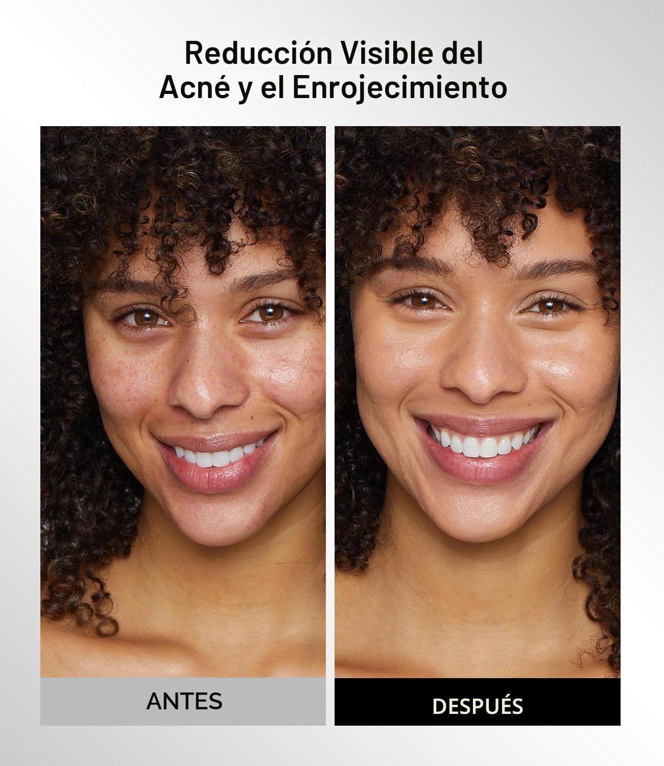 INIA Máscara de terapia de luz roja para cara, máscara facial LED i...