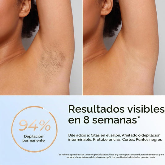 Finequin Depilación láser, depilación láser IPL para mujeres y homb...