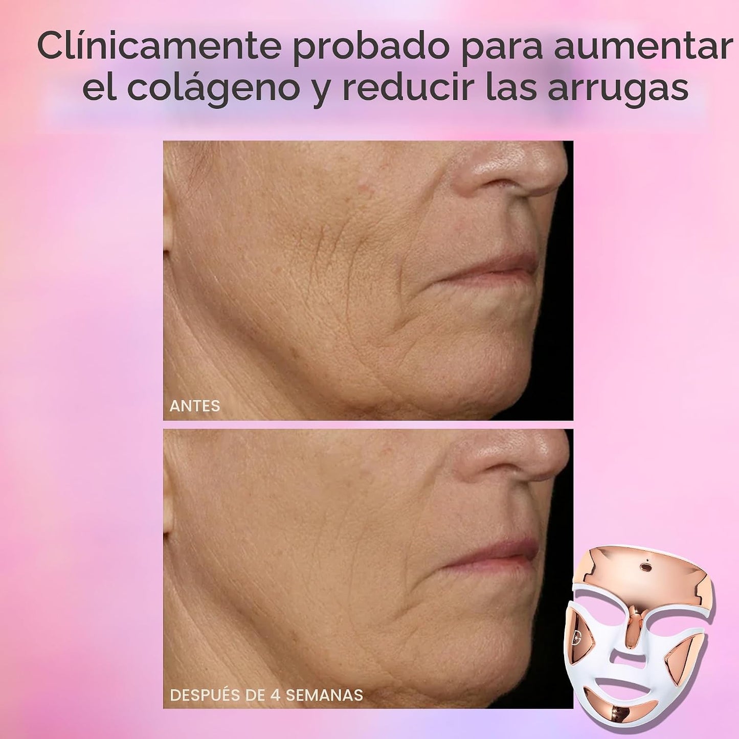 Dr. Dennis Gross DRx SpectraLite FaceWare Pro - Máscara facial LED...