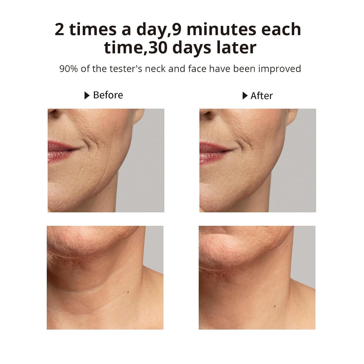 Masajeador facial Ms.W, dispositivo de luz roja y cuello (blanco)