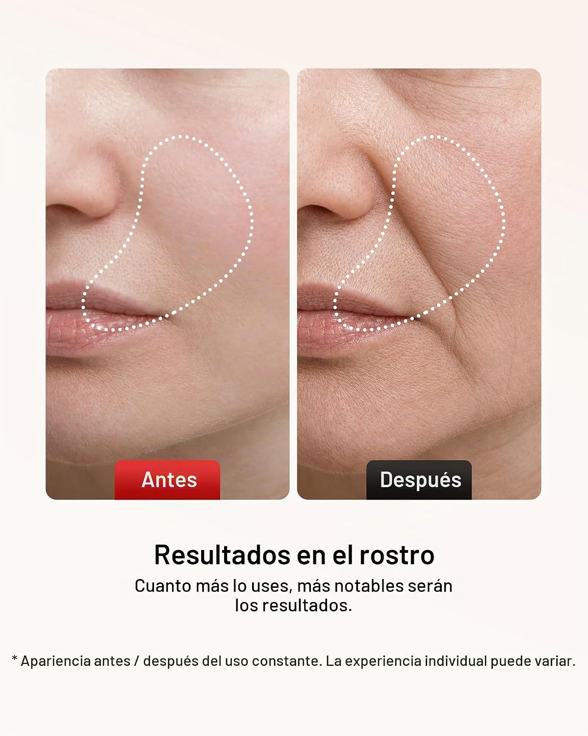 Pedete Masajeador facial, terapia de luz roja de 7 colores para car...