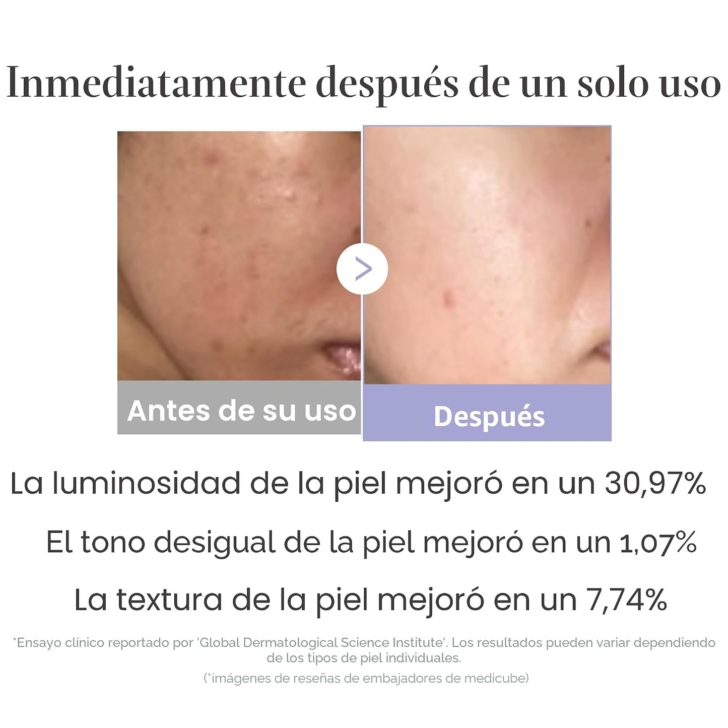 medicube Mini Booster Pro White | Dispositivo facial asequible en e...