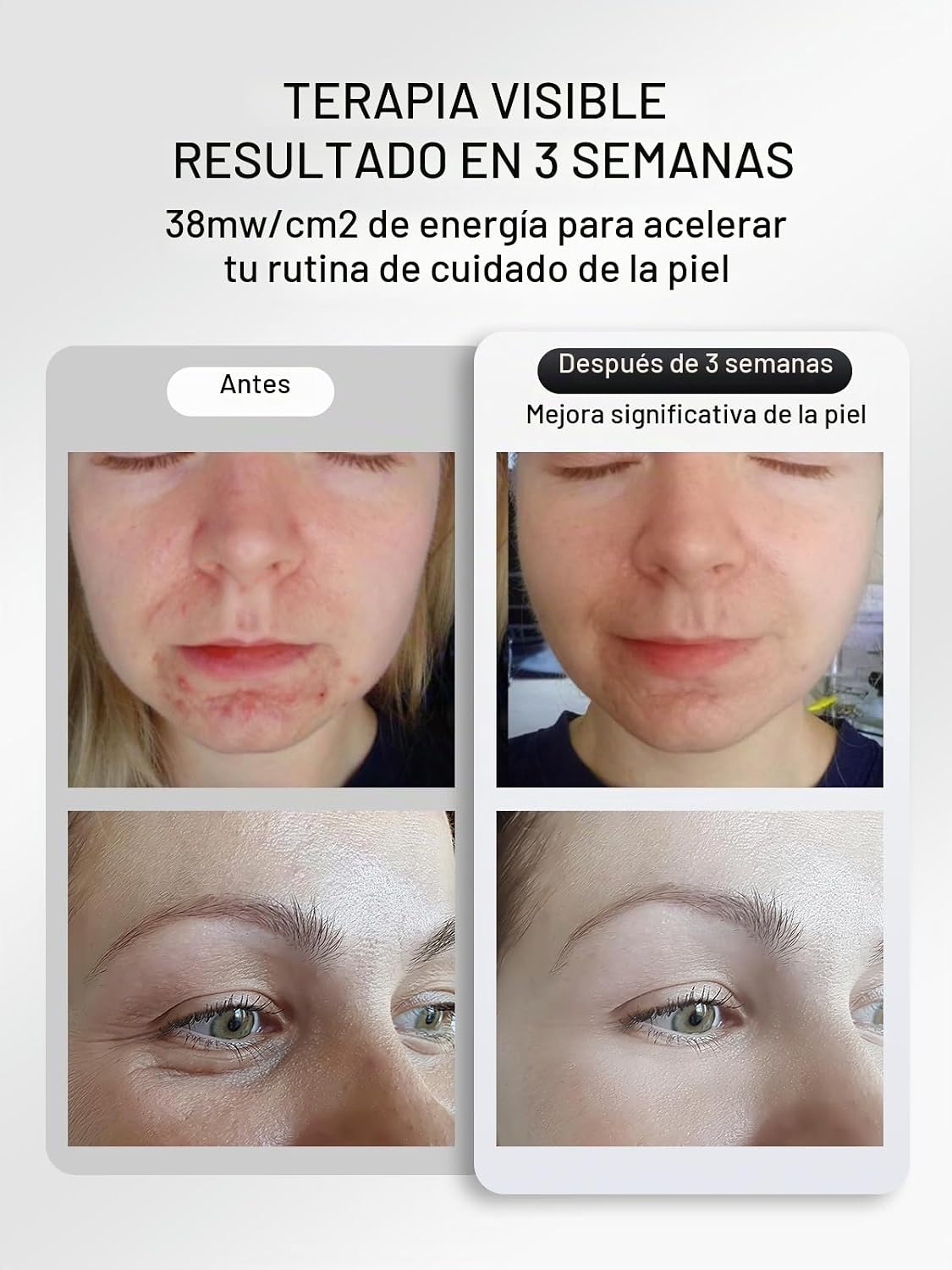 IBORRIA Terapia de luz roja para cara, máscara facial LED con luz i...