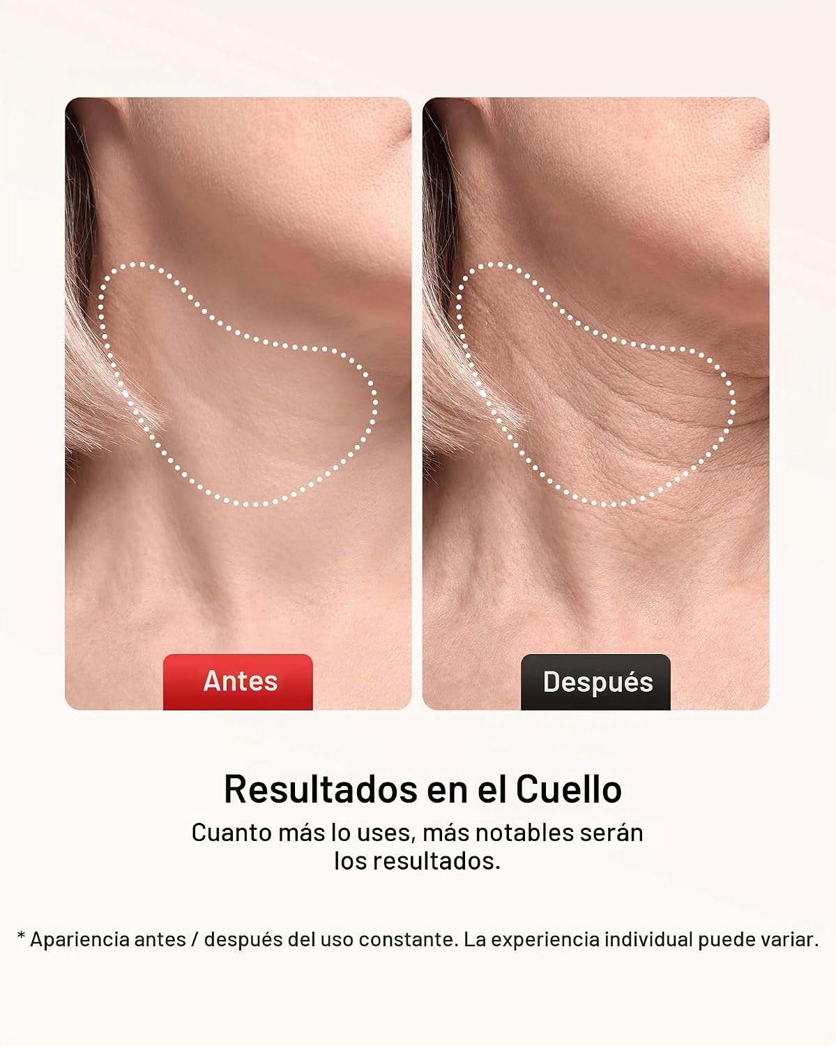 Pedete Masajeador facial, terapia de luz roja de 7 colores para car...